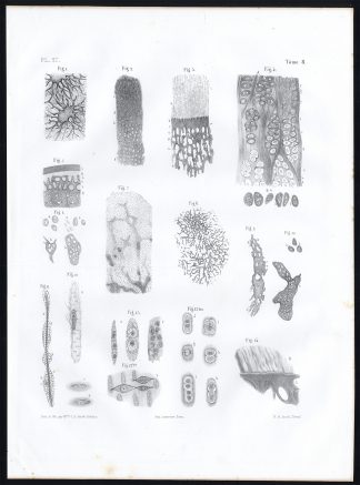 Antique Anatomy Print-MICROSCOPIC-BONE-JOINT-Pl. 27-Bourgery-1844