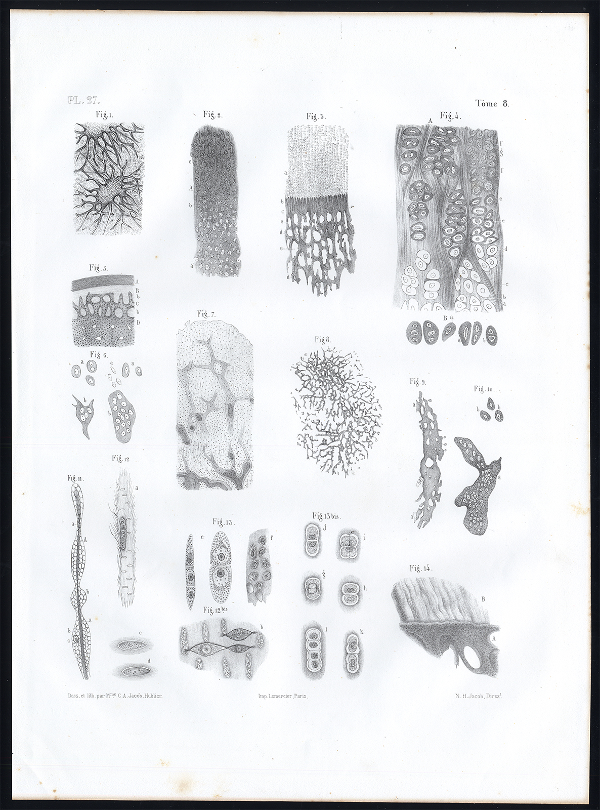, Antique Anatomy Print-MICROSCOPIC-BONE-JOINT-Pl. 27-Bourgery-1844, Pictura Antique Prints