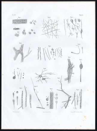 Antique Anatomy Print-MICROSCOPIC-NERVE-Pl. 32-Bourgery-1844