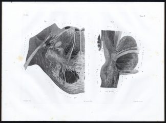 Antique Anatomy Print-MICROSCOPIC-NERVES-PONS VAROLII-Pl. 35-Bourgery-1844