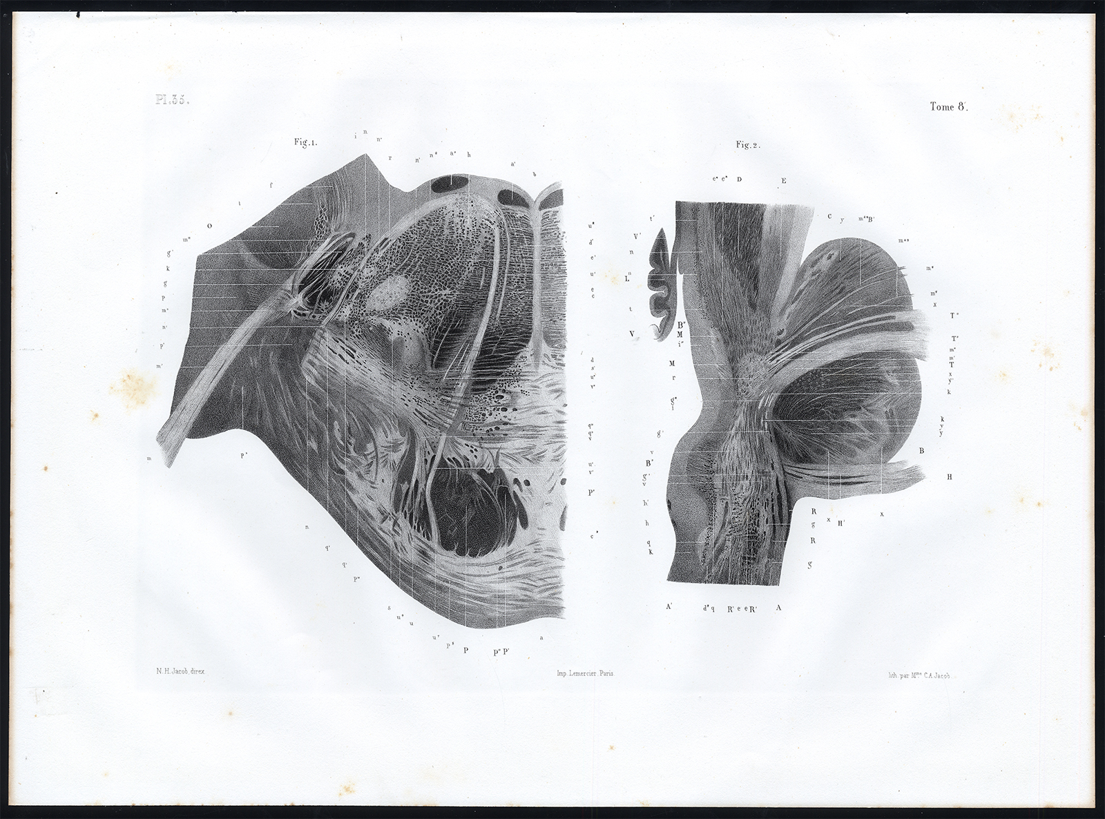 , Antique Anatomy Print-MICROSCOPIC-NERVES-PONS VAROLII-Pl. 35-Bourgery-1844, Pictura Antique Prints