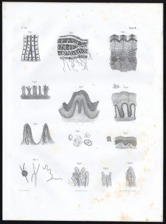 Antique Anatomy Print-MICROSCOPIC-SKIN-Pl. 39-Bourgery-1844