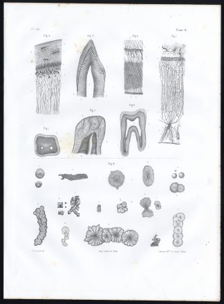 Antique Anatomy Print-MICROSCOPIC-TEETH-SALIVA-Pl. 44-Bourgery-1844