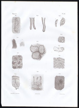 Antique Anatomy Print-PEYER'S PATCH-INTESTINAL VILLI-Pl. 46-Bourgery-1844