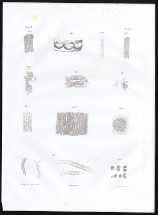 Antique Anatomy Print-MICROSCOPIC-VESSEL-ARTERY-Pl. 55-Bourgery-1844
