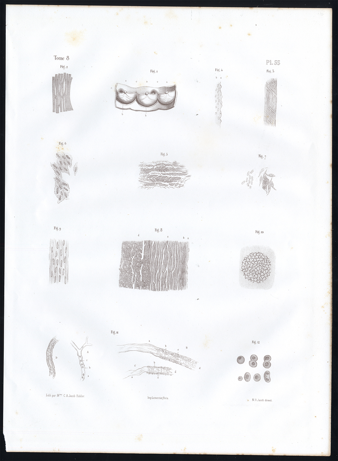 , Antique Anatomy Print-MICROSCOPIC-VESSEL-ARTERY-Pl. 55-Bourgery-1844, Pictura Antique Prints