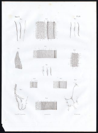 Antique Anatomy Print-MICROSCOPIC-VEIN-VESSEL-ARTERY-Pl. 56-Bourgery-1844