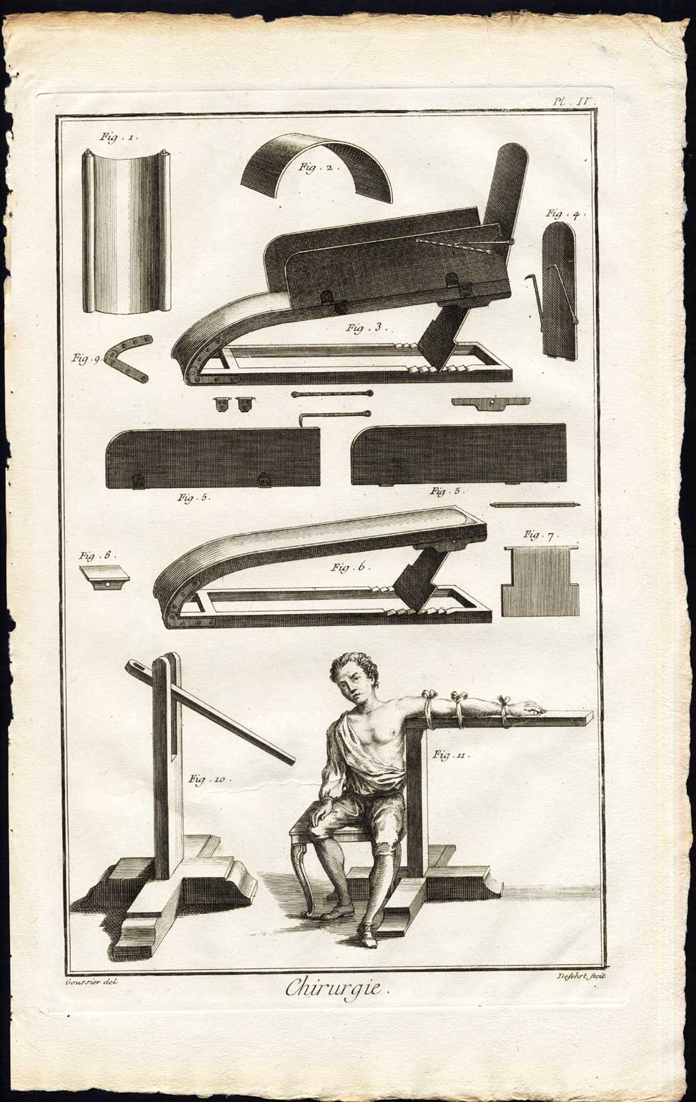 , Antique Print-SURGERY-MEDICAL INSTRUMENTS-FRACTURE-Diderot-Defehrt-1751, Pictura Antique Prints