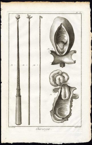 Antique Print-SURGERY-MEDICAL INSTRUMENTS-ESOPHAGUS-Diderot-Defehrt-1751