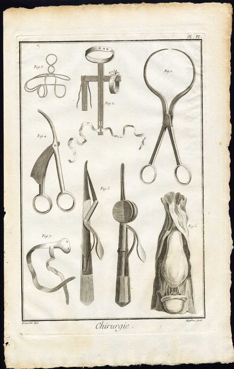 Bb010152 416x656 Antique Print-SURGERY-MEDICAL INSTRUMENTS-HERNIA-RICKETS-Diderot-Defehrt-1751
