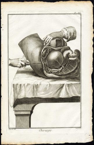 Antique Print-SURGERY-MEDICAL INSTRUMENT-HYPOGASTRIUM-Diderot-Defehrt-1751