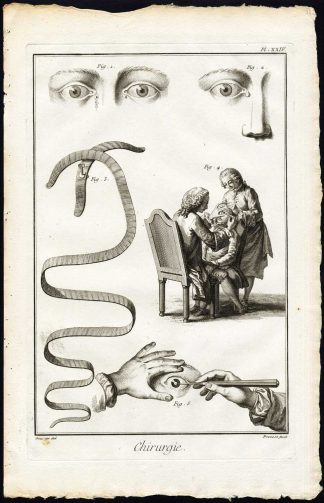 Antique Print-SURGERY-MEDICAL INSTRUMENT-CATARACT-EYE-Diderot-Prevost-1751