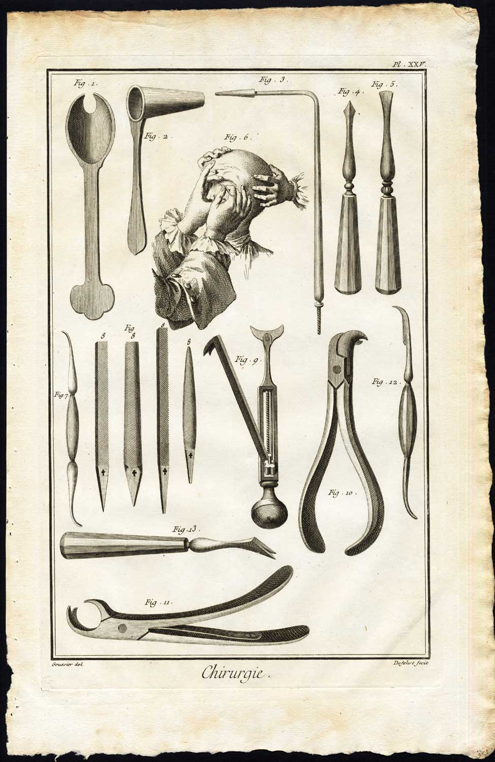 , Antique Print-SURGERY-MEDICAL INSTRUMENT-TEETH-EYE-Diderot-Defehrt-1751, Pictura Antique Prints