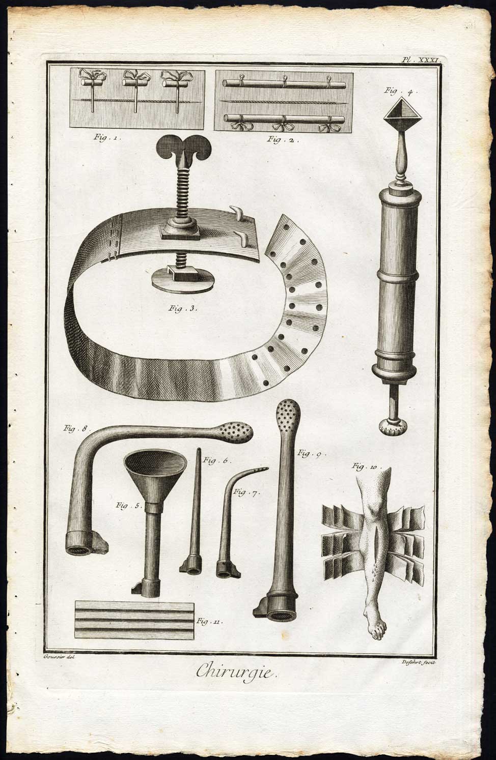 Bb010179 416x638 Antique Print-SURGERY-MEDICAL INSTRUMENT-SYRINGE-TOURNIQUET-Diderot-Defehrt-1751