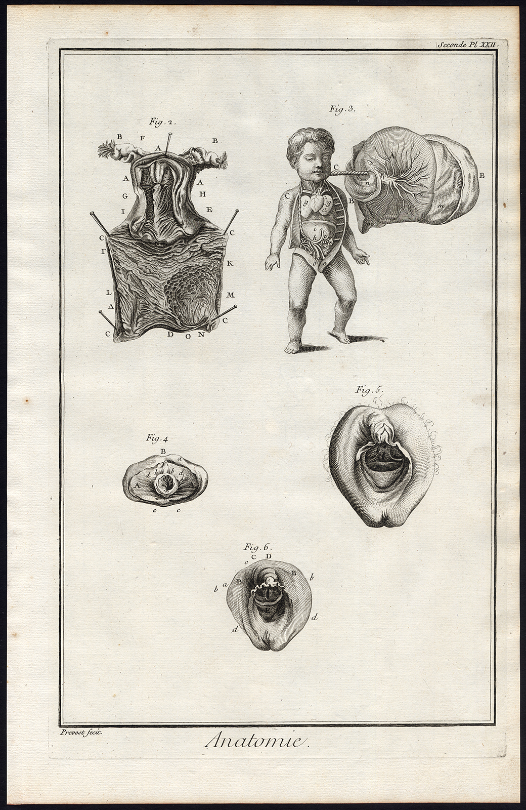 Bb14071a 2 416x640 Antique Print-ANATOMY-FEMALE REPRODUCTIVE SYSTEM-UTERUS-Diderot-Defehrt-1751 - Image 2