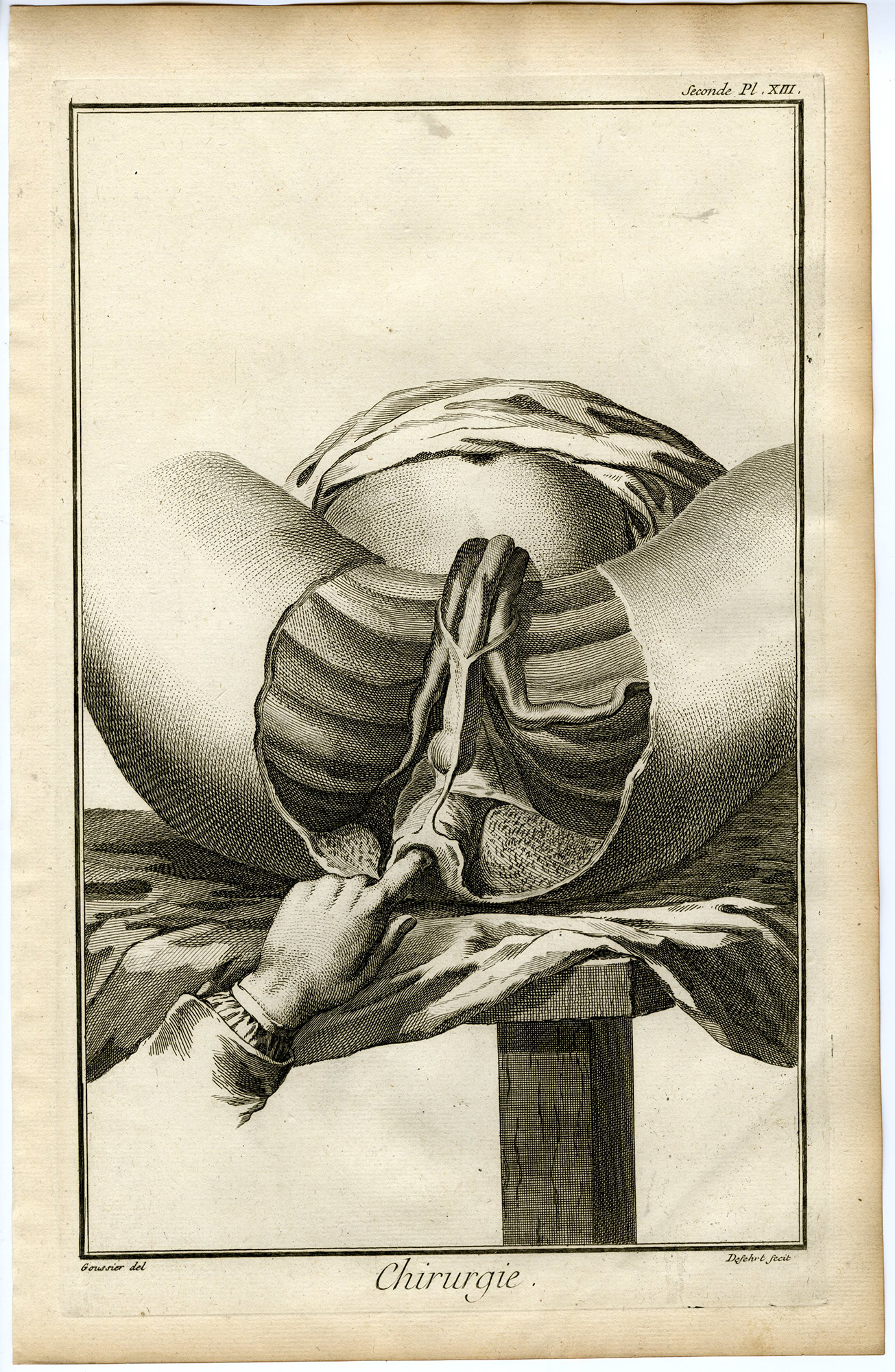 , Antique Print-SURGERY-MEDICAL INSTRUMENT-MUSCLES-PERINEUM-Diderot-Defehrt-1751, Pictura Antique Prints