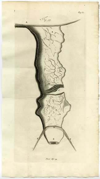 Antique Print-TUMOUR-STOMACH-BIRTH-WOMB-FIG 53-Ruysch-Huyberts-1744