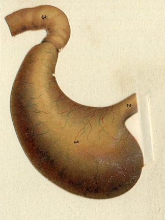 Antique Medical Print-STOMACH-Lithograph-1890