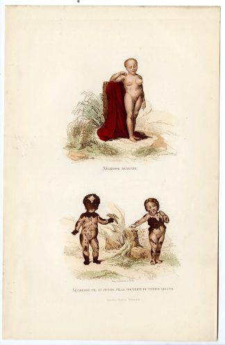 Antique Print-NEGROID WOMAN-CHILDREN-SKIN CONDITION-Lerouge-Buffon-1853