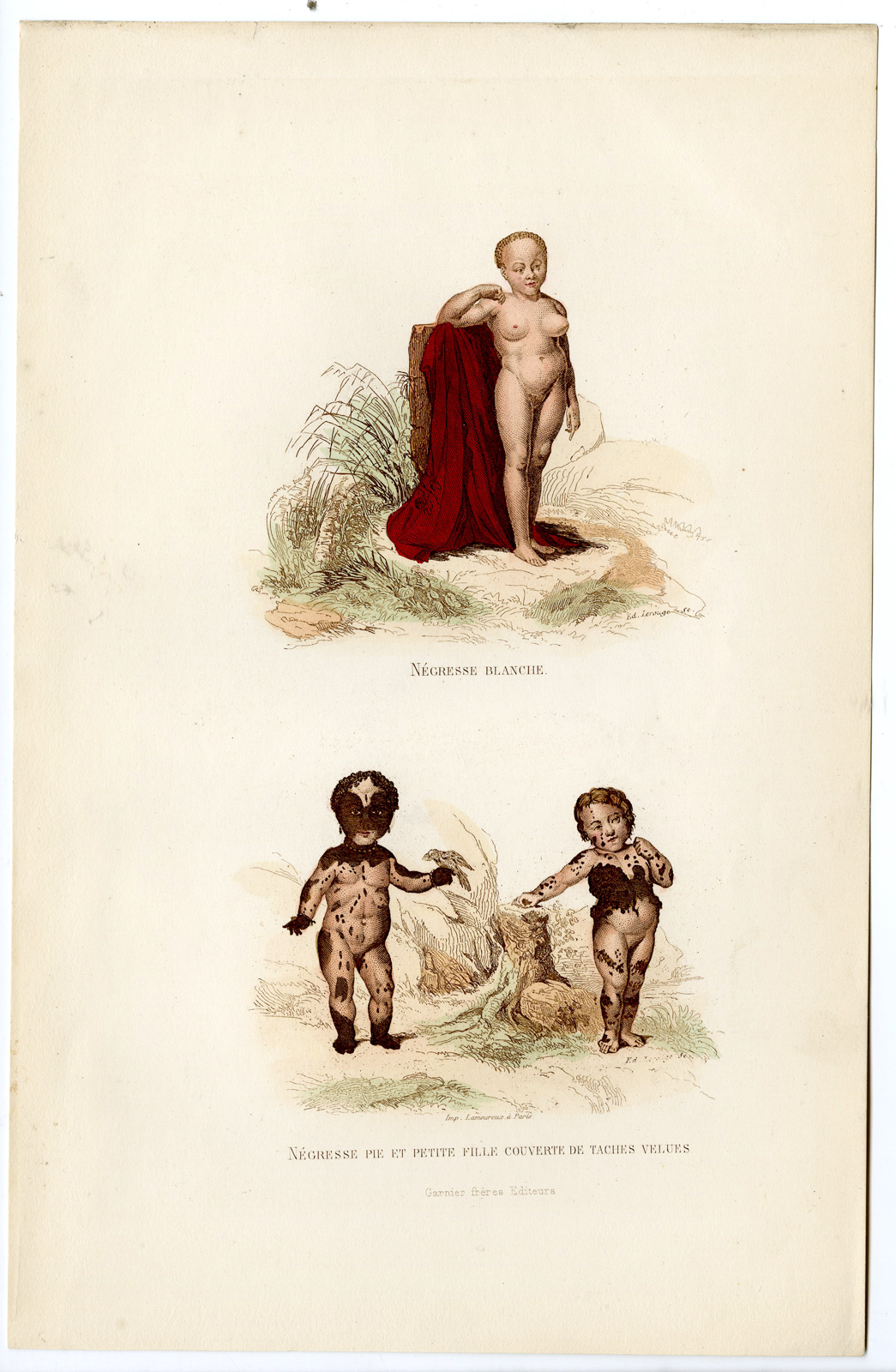 , Antique Print-NEGROID WOMAN-CHILDREN-SKIN CONDITION-Lerouge-Buffon-1853, Pictura Antique Prints