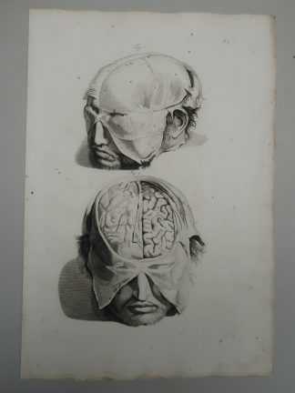 5-Antique Prints-T.5-9.-BRAIN-ANATOMY-MENINGES-CRANIAL-de Lairesse-Bidloo-1728
