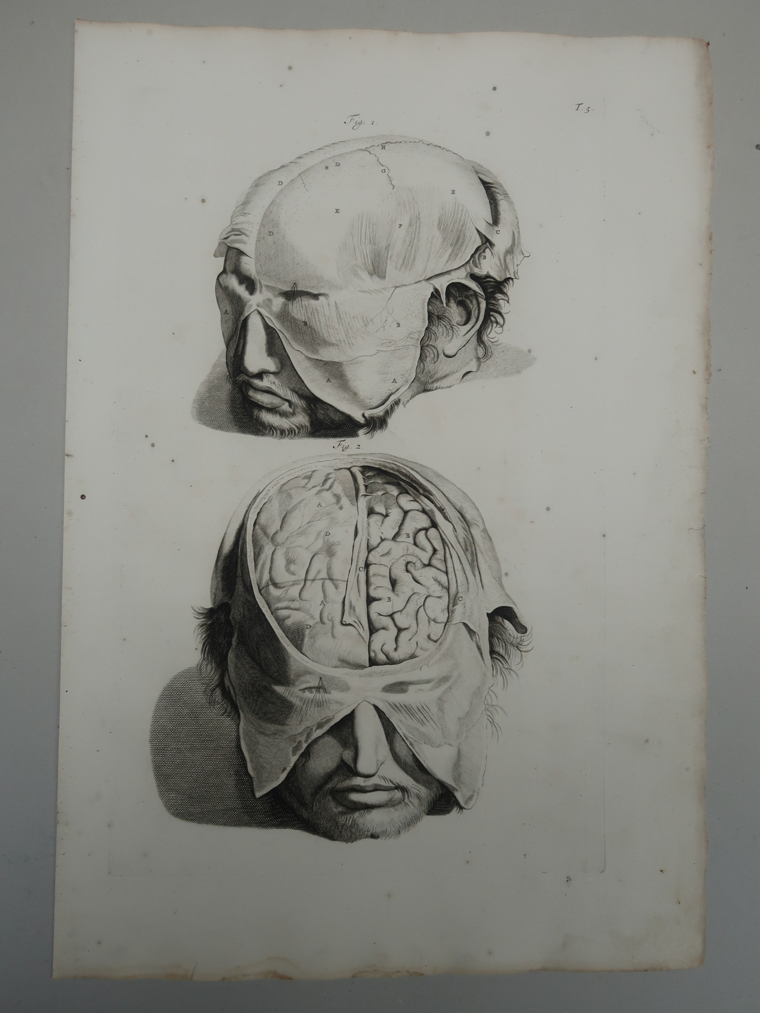, 5-Antique Prints-T.5-9.-BRAIN-ANATOMY-MENINGES-CRANIAL-de Lairesse-Bidloo-1728, Pictura Antique Prints
