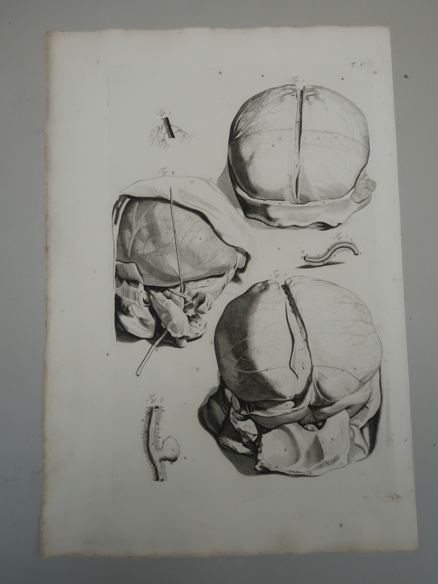 , 5-Antique Prints-T.5-9.-BRAIN-ANATOMY-MENINGES-CRANIAL-de Lairesse-Bidloo-1728, Pictura Antique Prints