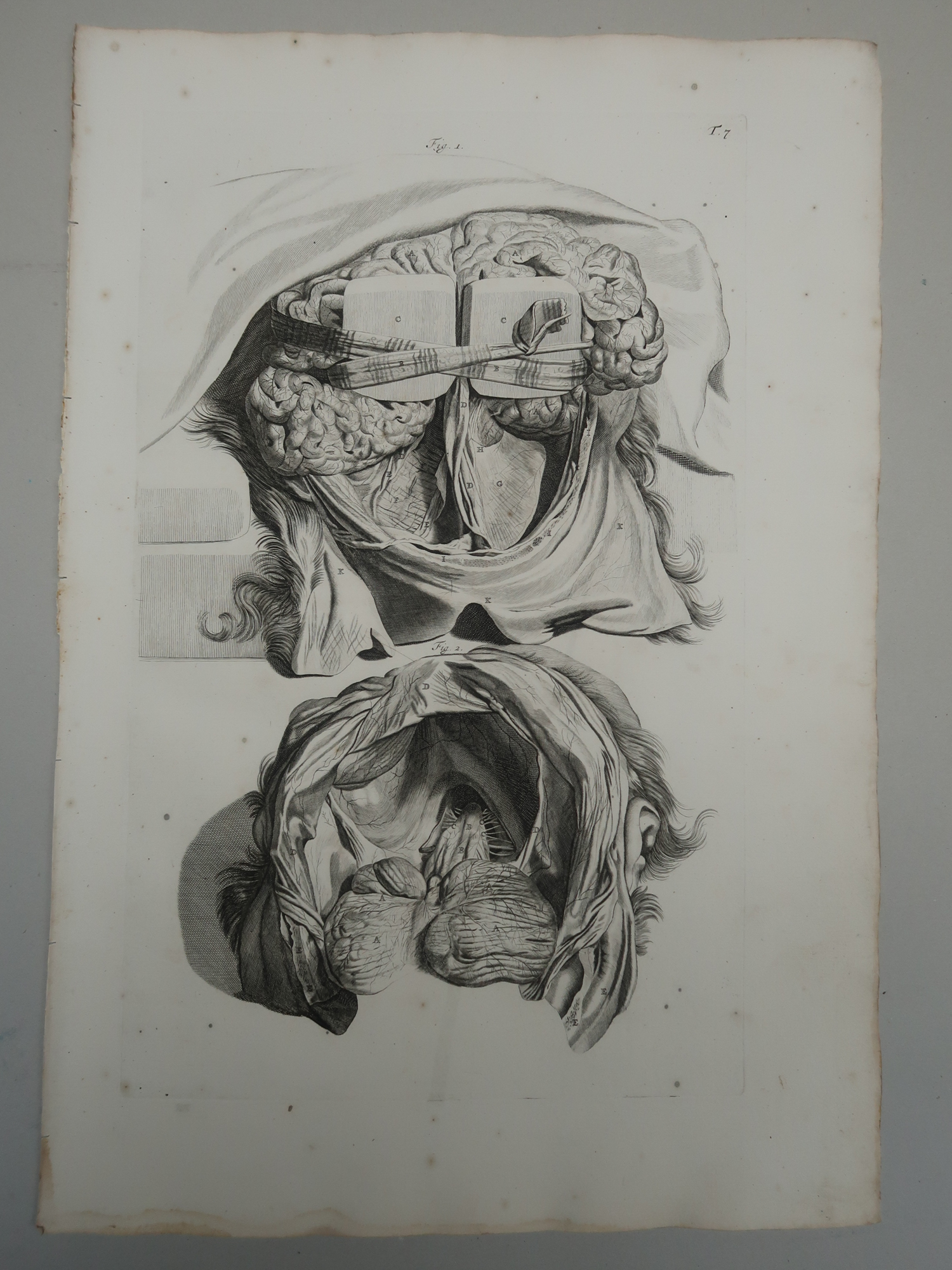 , 5-Antique Prints-T.5-9.-BRAIN-ANATOMY-MENINGES-CRANIAL-de Lairesse-Bidloo-1728, Pictura Antique Prints
