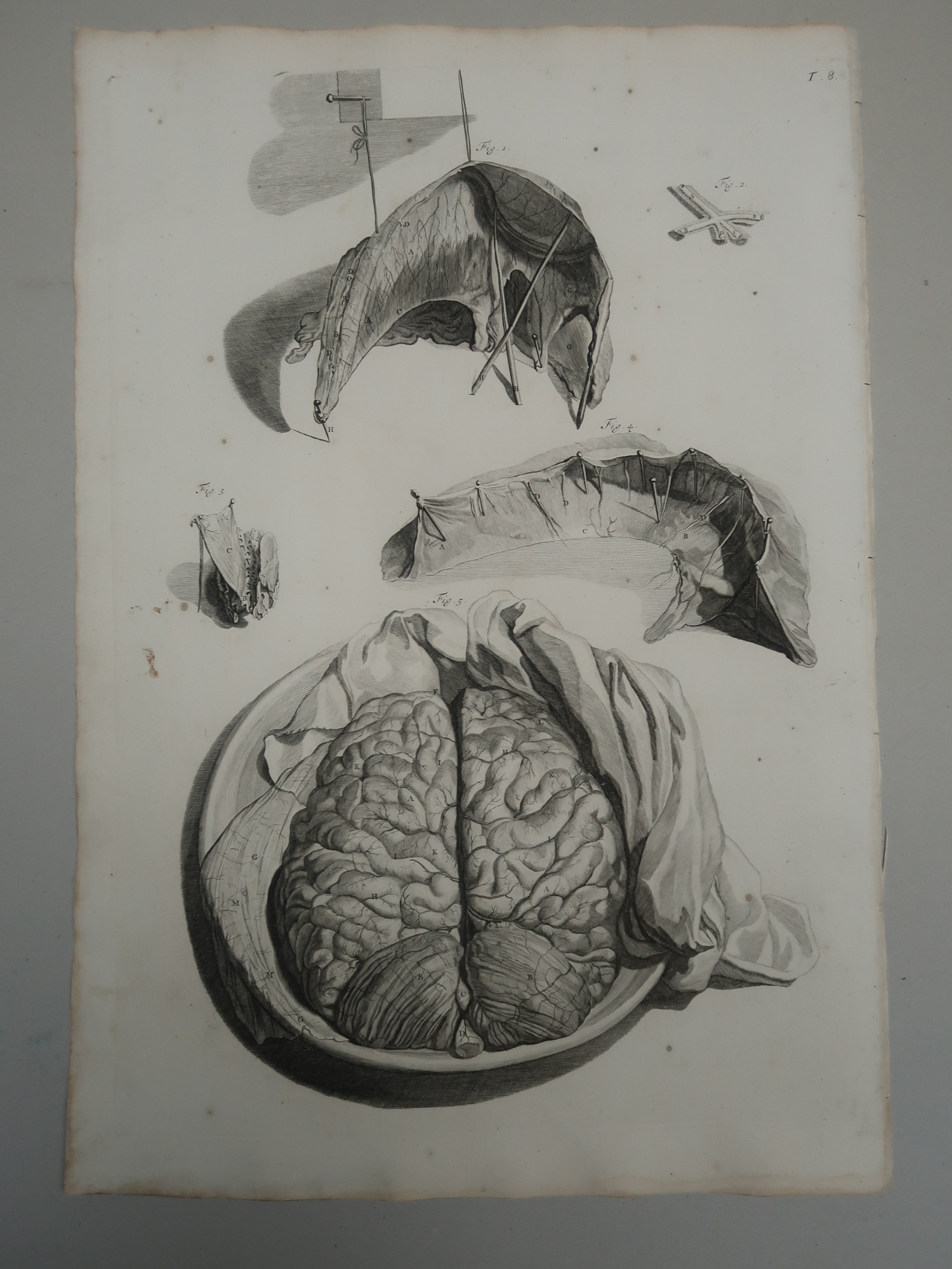 , 5-Antique Prints-T.5-9.-BRAIN-ANATOMY-MENINGES-CRANIAL-de Lairesse-Bidloo-1728, Pictura Antique Prints