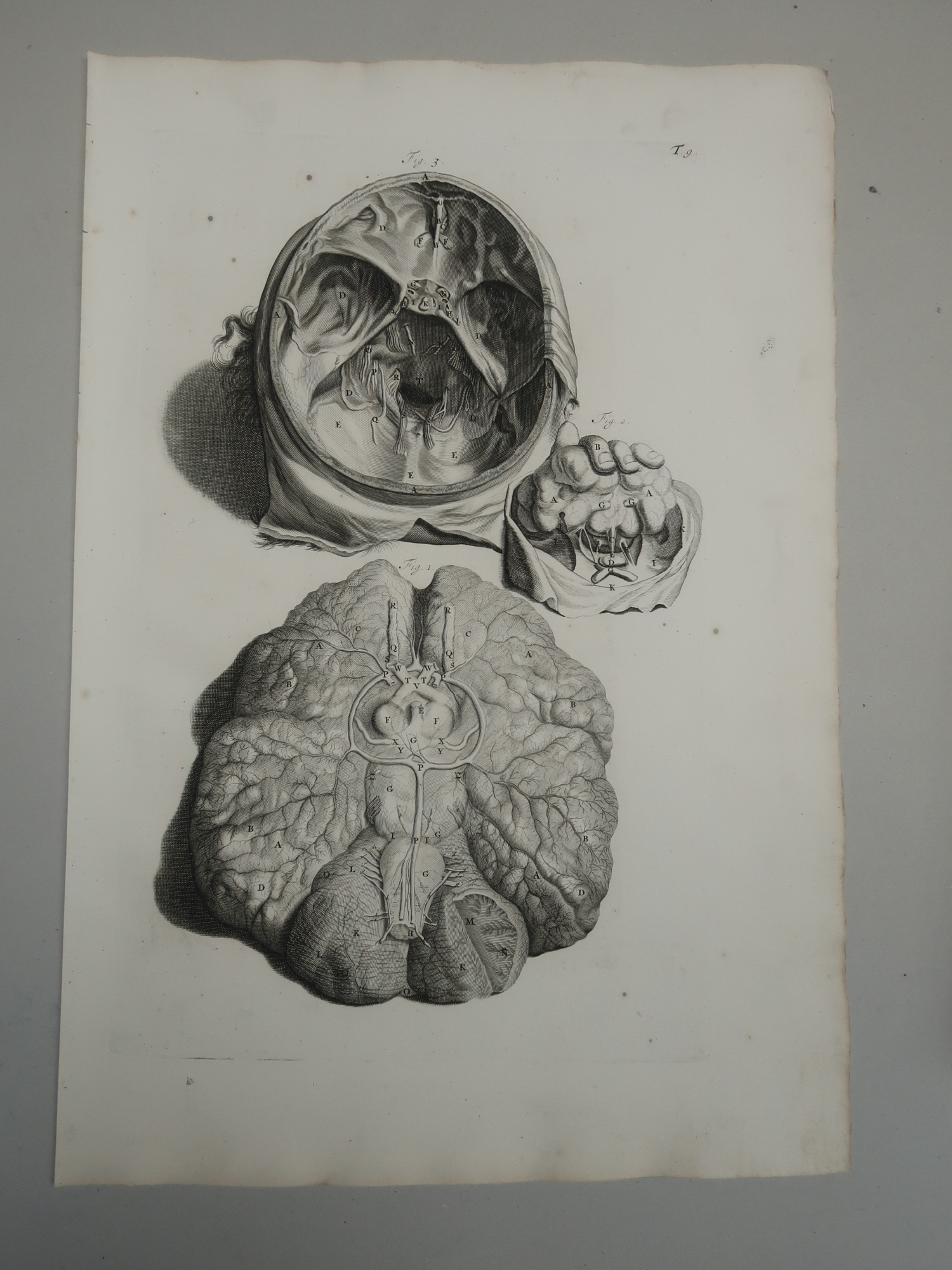 , 5-Antique Prints-T.5-9.-BRAIN-ANATOMY-MENINGES-CRANIAL-de Lairesse-Bidloo-1728, Pictura Antique Prints