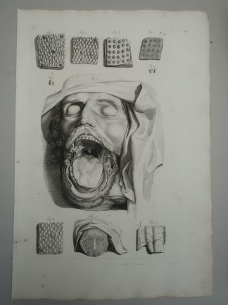 Antique Print-T.13.-TONGUE-TASTE-PAPILLAE-ORAL-ANATOMY-de Lairesse-Bidloo-1728