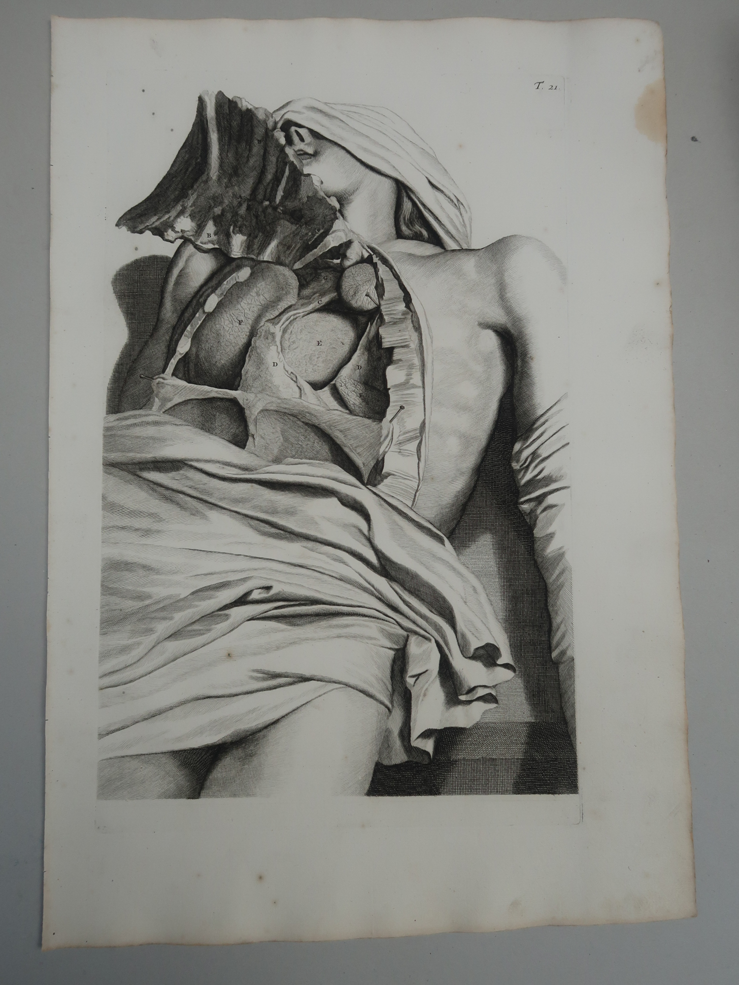 , Antique Print-T.21.-ANATOMY-THORAX-DISSECTION-HEART-LUNG-de Lairesse-Bidloo-1728, Pictura Antique Prints