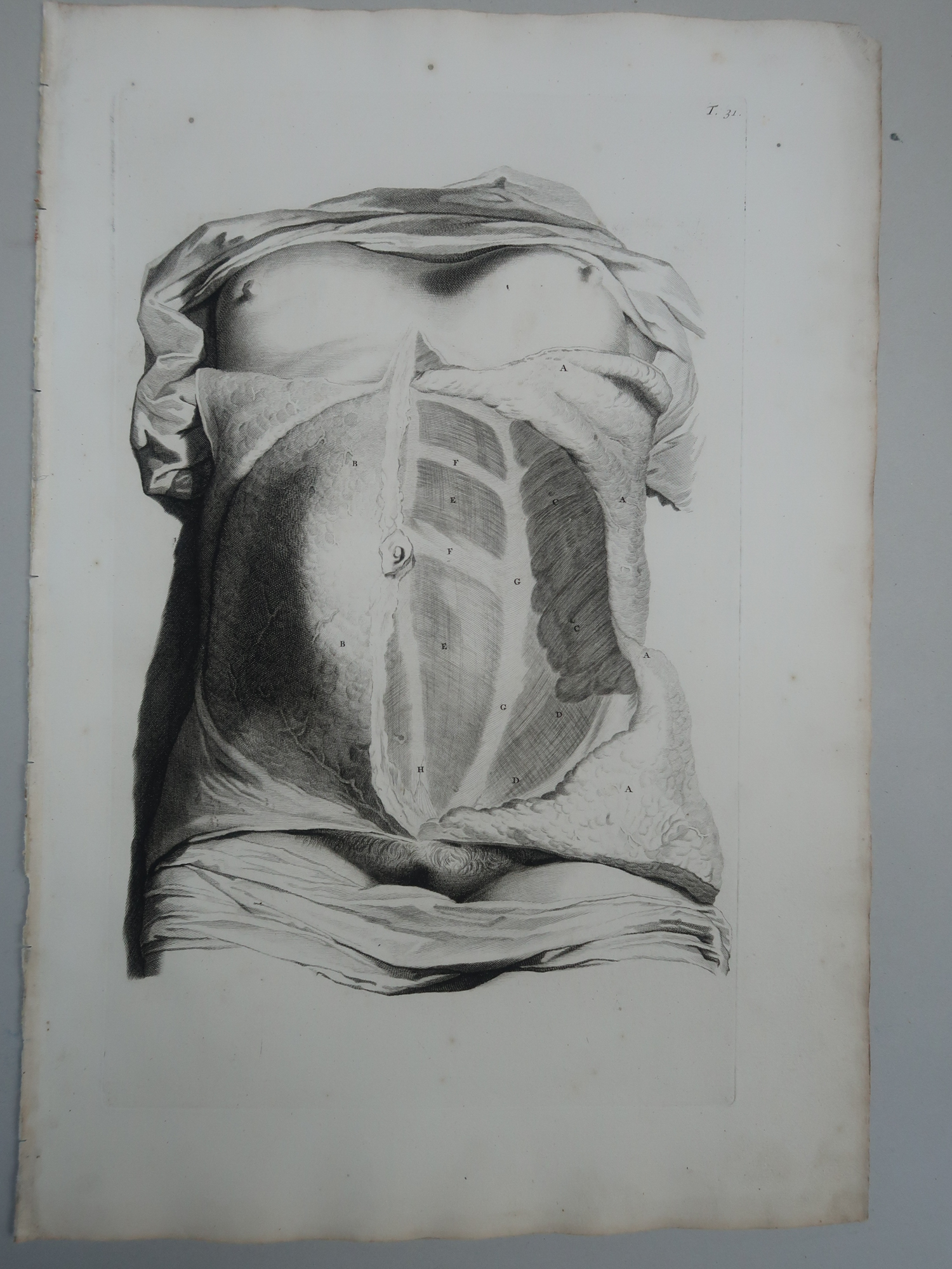 , Antique Print-T.31.-ABDOMINAL-MUSCLES-HUMAN-ANATOMY
-de Lairesse-Bidloo-1728, Pictura Antique Prints