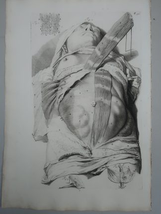 Antique Print-T.32.-ABDOMINAL-WALL-MUSCLES-NERVES-ANATOMY-Lairesse-Bidloo-1728