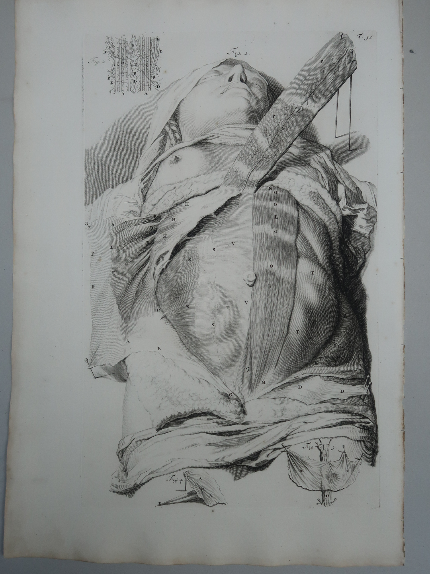 , Antique Print-T.32.-ABDOMINAL-WALL-MUSCLES-NERVES-ANATOMY-Lairesse-Bidloo-1728, Pictura Antique Prints