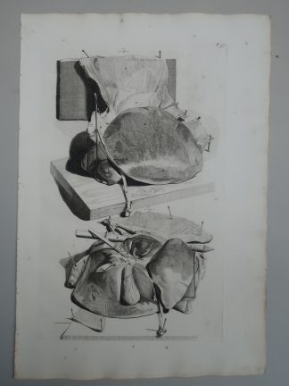 Antique Print-T.37.-LIVER-GALLBLADDER-BILE-DUCTS-ANATOMY-de Lairesse-Bidloo-1728