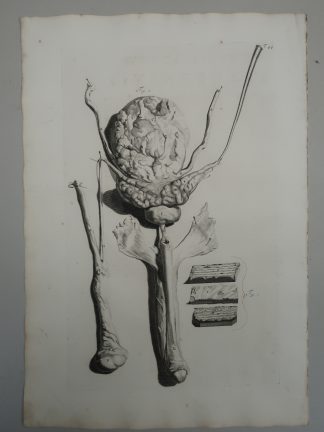 Antique Print-T.44.-MALE-URINARY-TRACT-BLADDER-TESTIS-de Lairesse-Bidloo-1728