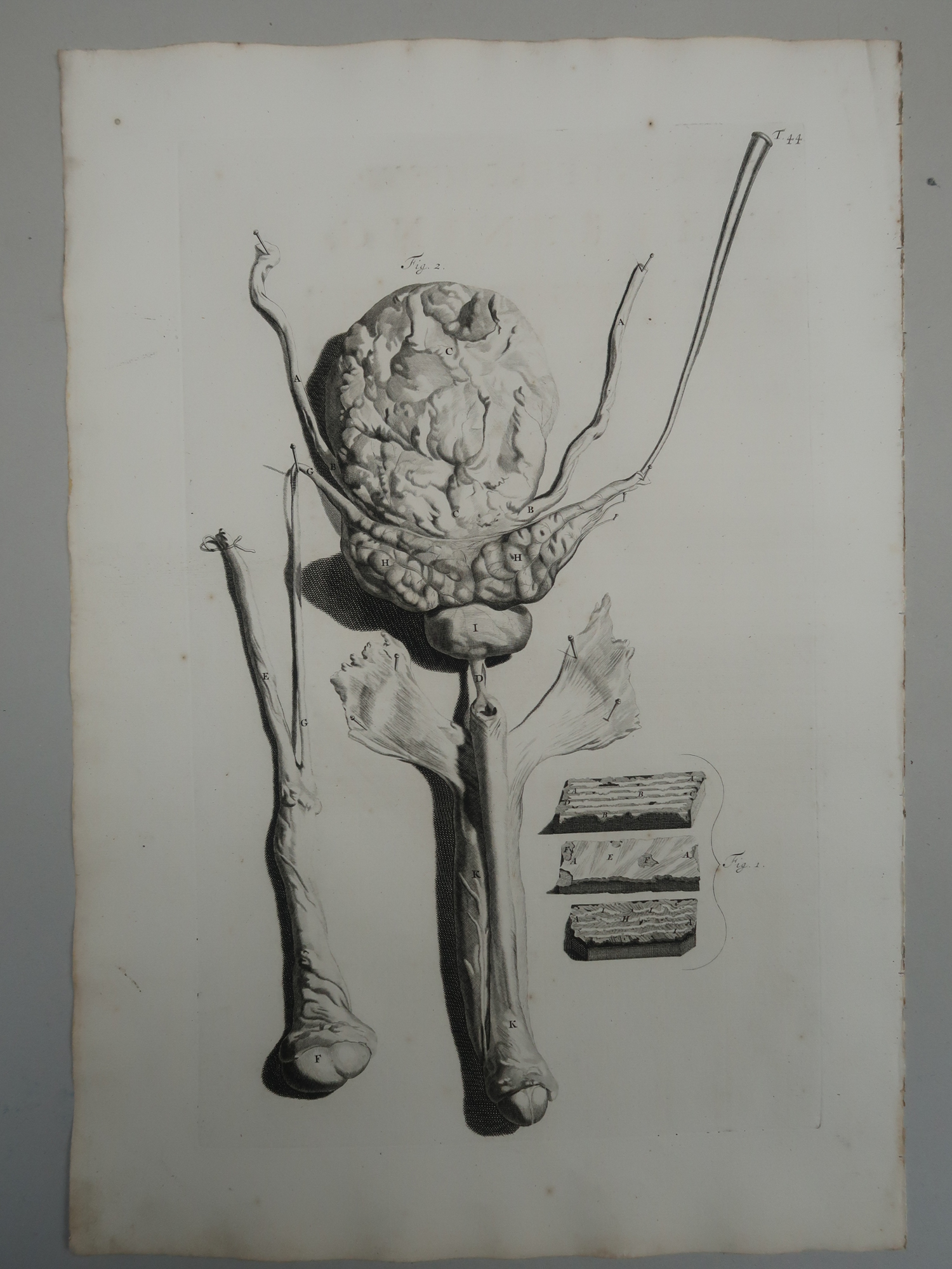 , Antique Print-T.44.-MALE-URINARY-TRACT-BLADDER-TESTIS-de Lairesse-Bidloo-1728, Pictura Antique Prints