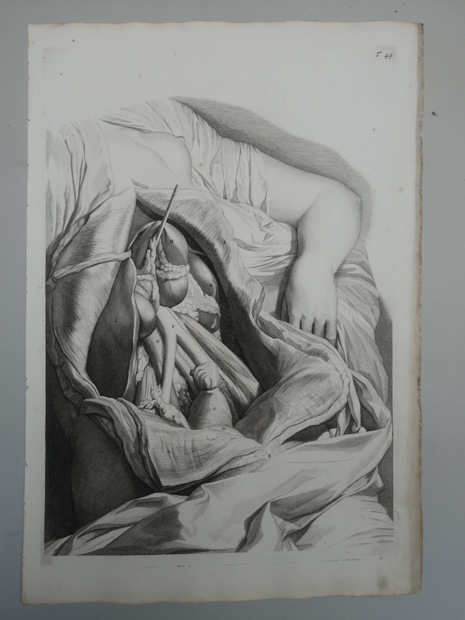 , Antique Print-T.49.-ANATOMY-FEMALE-UTERUS-PELVIS-CAVITY-de Lairesse-Bidloo-1728, Pictura Antique Prints