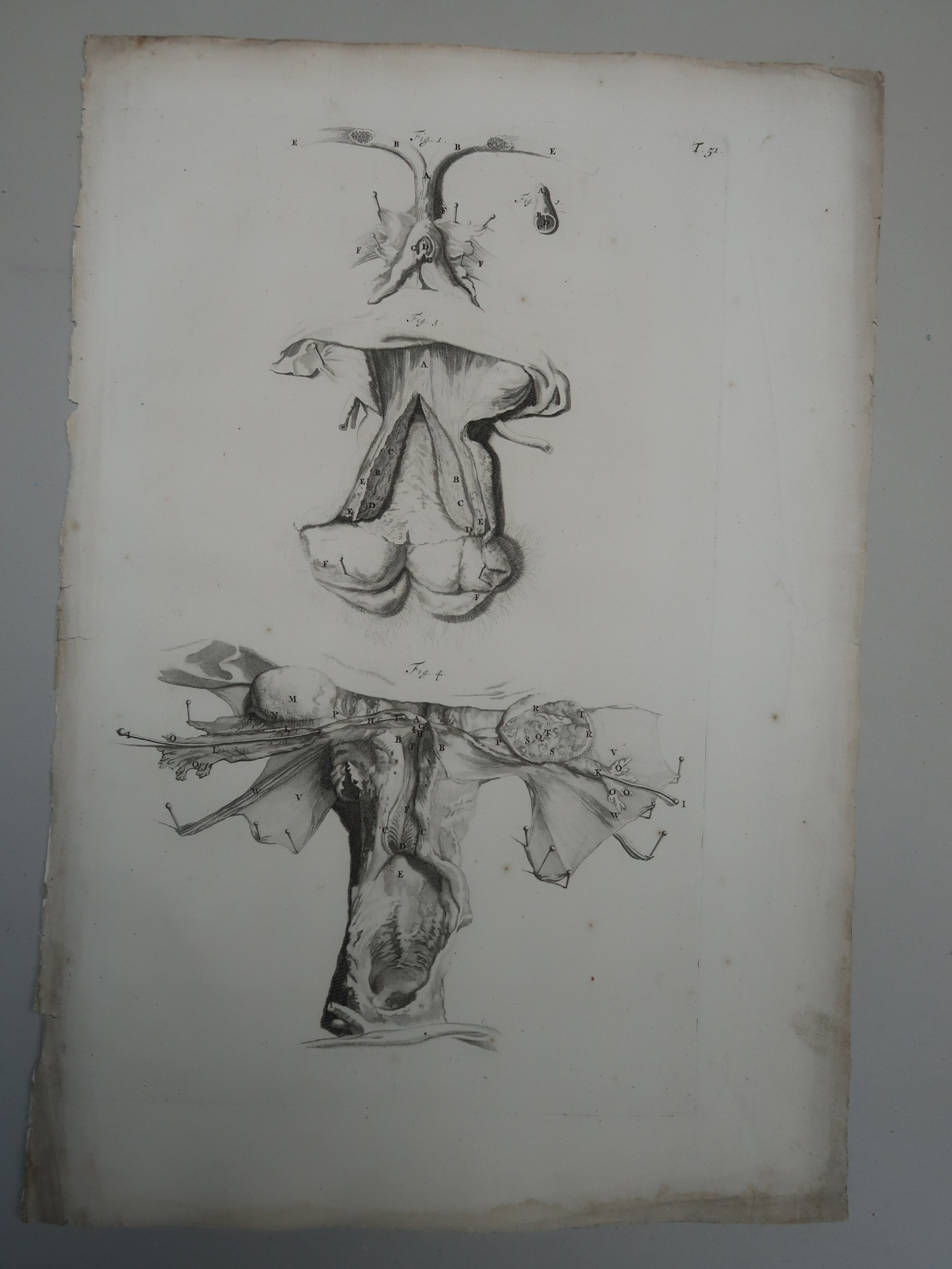 , Antique Print-T.51.-ANATOMY-FEMALE-REPRODUCTIVE-ORGANS-de Lairesse-Bidloo-1728, Pictura Antique Prints