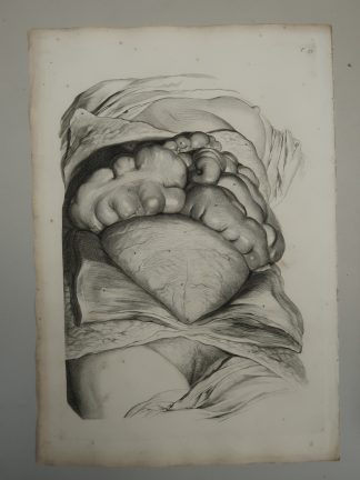Antique Print-T.54.-ANATOMY-PREGNANT-WOMAN-de Lairesse-Bidloo-1728