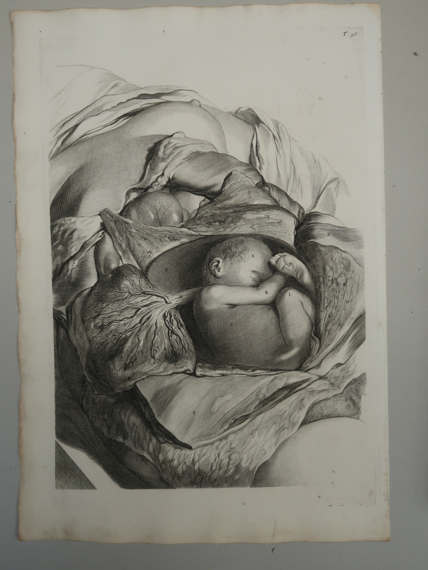 , Antique Print-T.56.-ANATOMY-FETUS-IN-UTERO-PLACENTA-UMBILICAL-CORD-de Lairesse-Bidloo-1728, Pictura Antique Prints