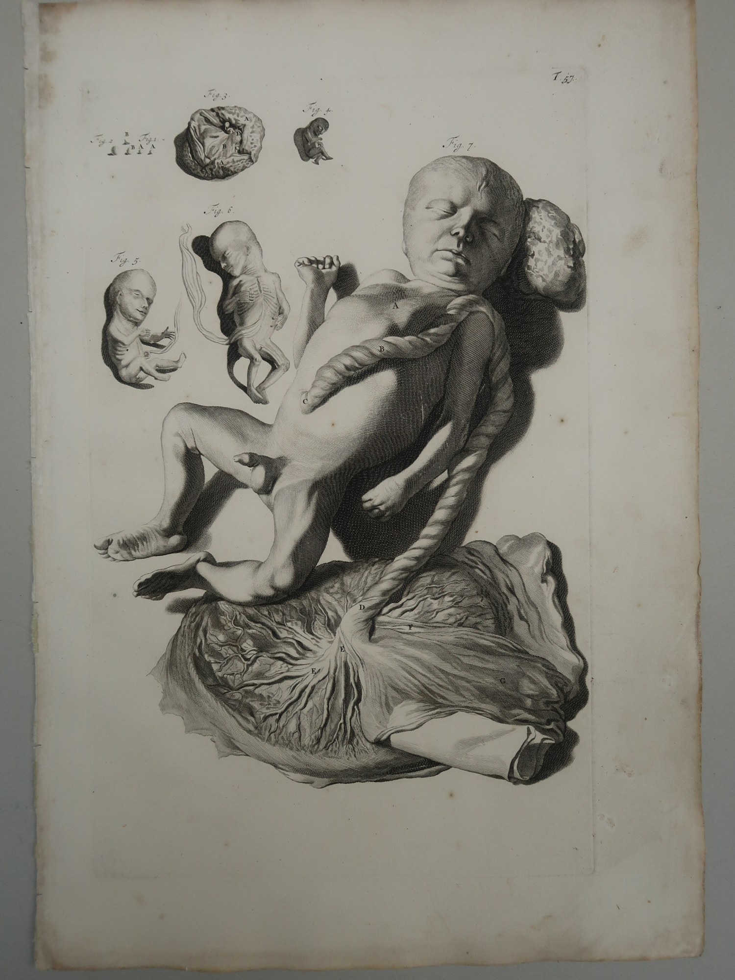 , Antique Print-T.57.-ANATOMY-FETAL-DEVELOPMENT-STAGES-de Lairesse-Bidloo-1728, Pictura Antique Prints
