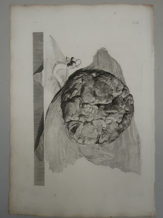 Antique Print-T.58.-ANATOMY-PLACENTA-MATERNAL-SIDE-de Lairesse-Bidloo-1728