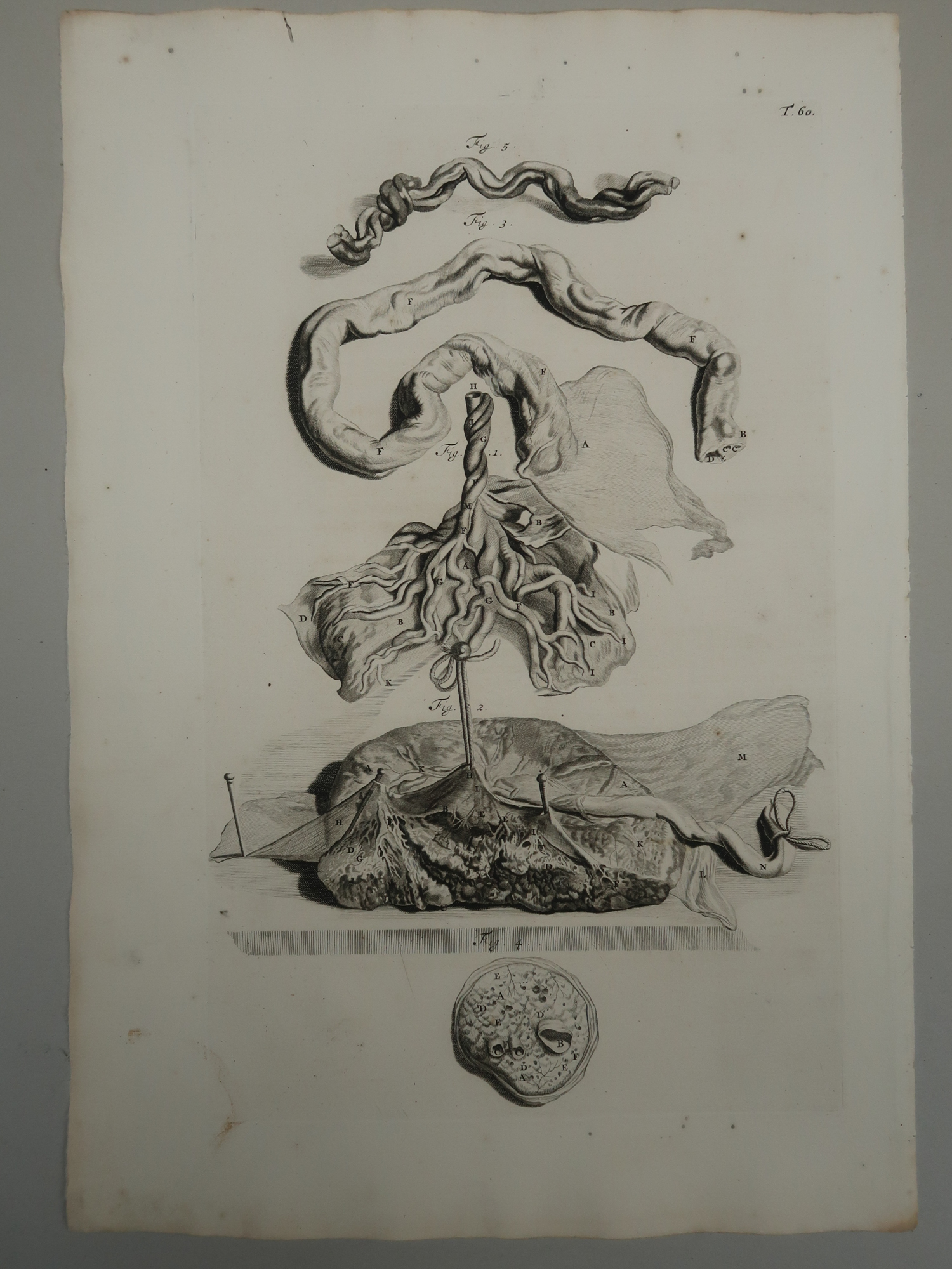 , Antique Print-T.60.-ANATOMY-PLACENTA-UMBILICAL-CORD-de Lairesse-Bidloo-1728, Pictura Antique Prints