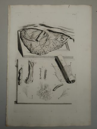 Antique Print-T.61.-PLACENTA-UMBILICAL-VESSELS-MEMBRANES-de Lairesse-Bidloo-1728