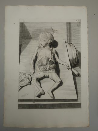 Antique Print-T.62.-FETAL-ANATOMY-INFANT-de Lairesse-Bidloo-1728
