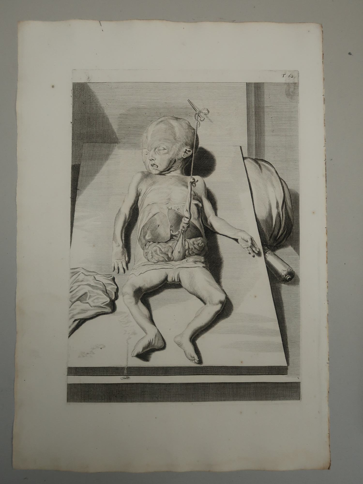 , Antique Print-T.62.-FETAL-ANATOMY-INFANT-de Lairesse-Bidloo-1728, Pictura Antique Prints