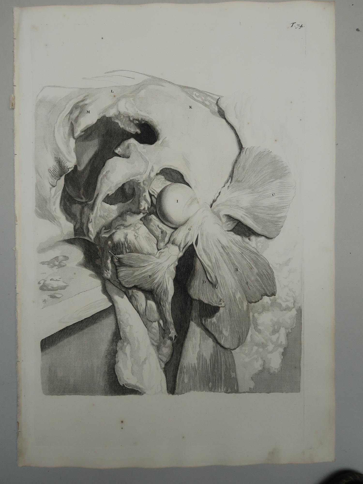 , Antique Print-T.74.-HIP-JOINT-DISSECTION-GLUTEAL-MUSCLES-de Lairesse-Bidloo-1728, Pictura Antique Prints