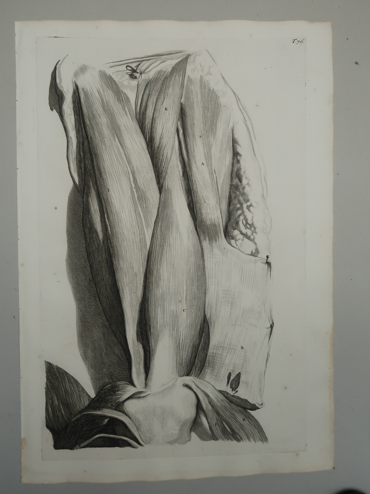 , Antique Print-T.76.-THIGH-MUSCULATURE-QUADRICEPS-ANTERIOR-Lairesse-Bidloo-1728, Pictura Antique Prints